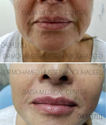 مركز غاغا الطبي والتجميل - الفجيرة - +971 4 341 7111